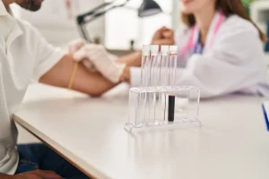 blood-sample-being-collected -for-cBc-test-in-a-clinical lab